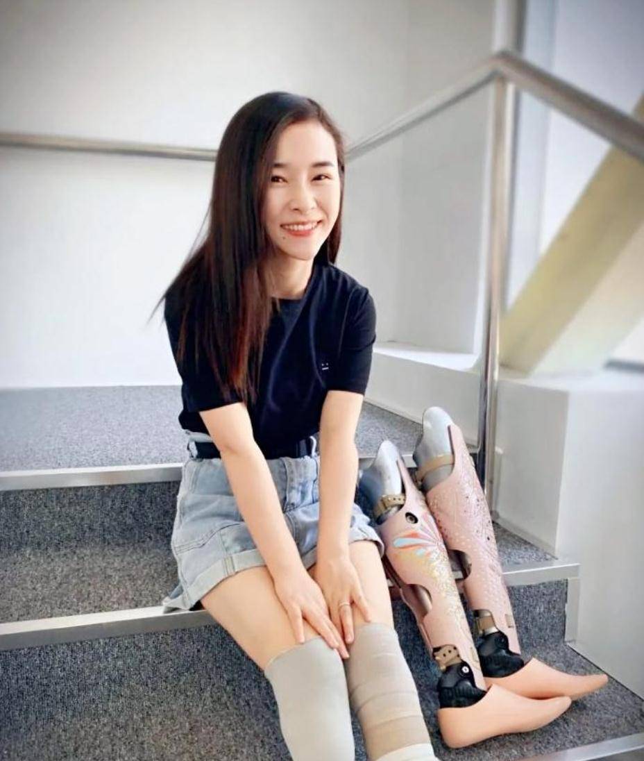 廖智:在地震中失去双腿和女儿,重生后遇真爱,如今婚姻美满幸福_假肢