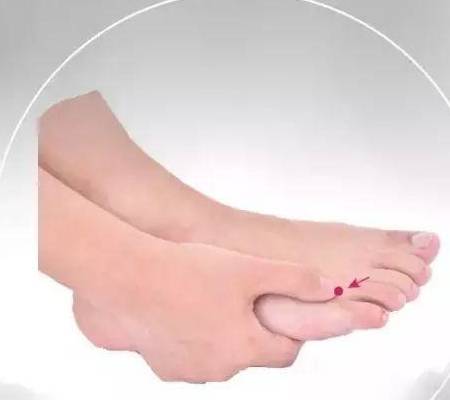 中医泄肝火妙法——刺激侠溪穴!_治疗_按摩_功效