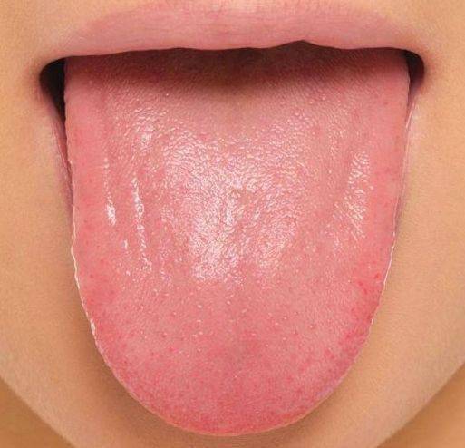 通过舌苔看健康
