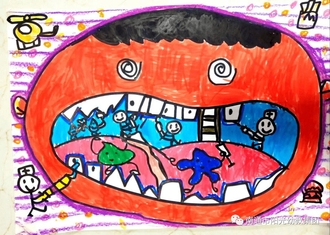 大班幼儿进入换牙期,孩子们对这一现象有着