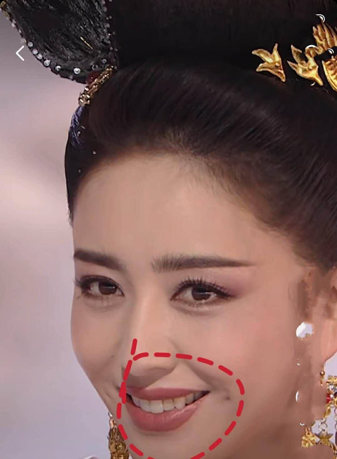 不过在最后微微一笑的时候,却被黄牙拉低分,佟丽娅的牙齿虽然不整齐