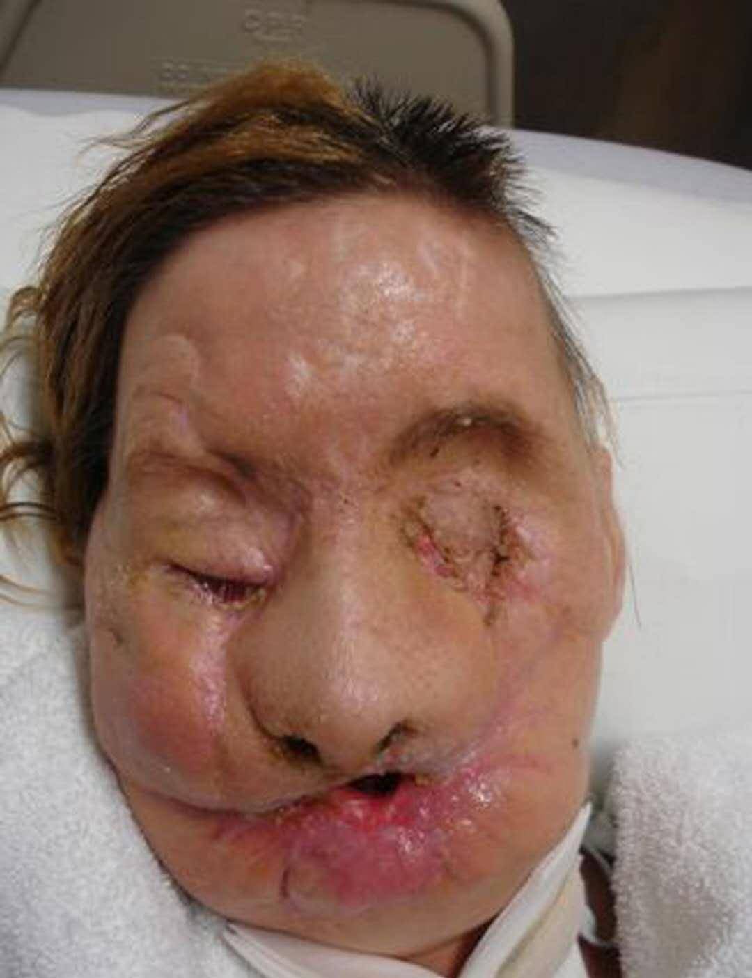 它却残忍啃掉朋友脸皮,面目全非看不清五官