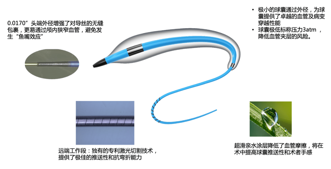 先瑞达NEO-Skater颅内球囊扩张导管获批上市_产品_血管_临床