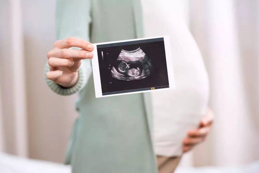 孕期B超单图片