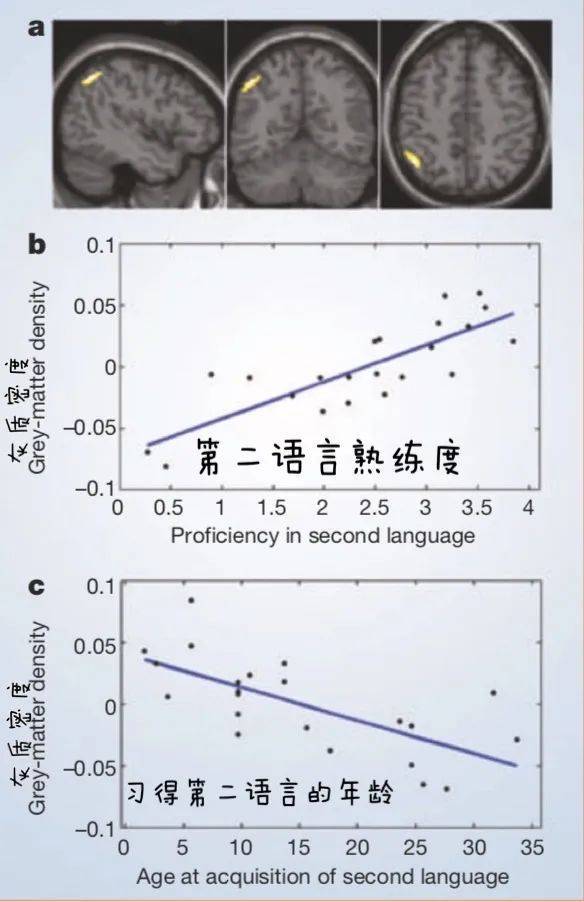 一般而言,大脑的灰质密度越高,智力测试表现越好,智商也就越高