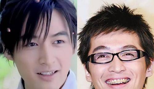 "整牙"如换头的5位明星:杨幂,baby秒变脸,胡歌颜值变化大_牙齿_手术
