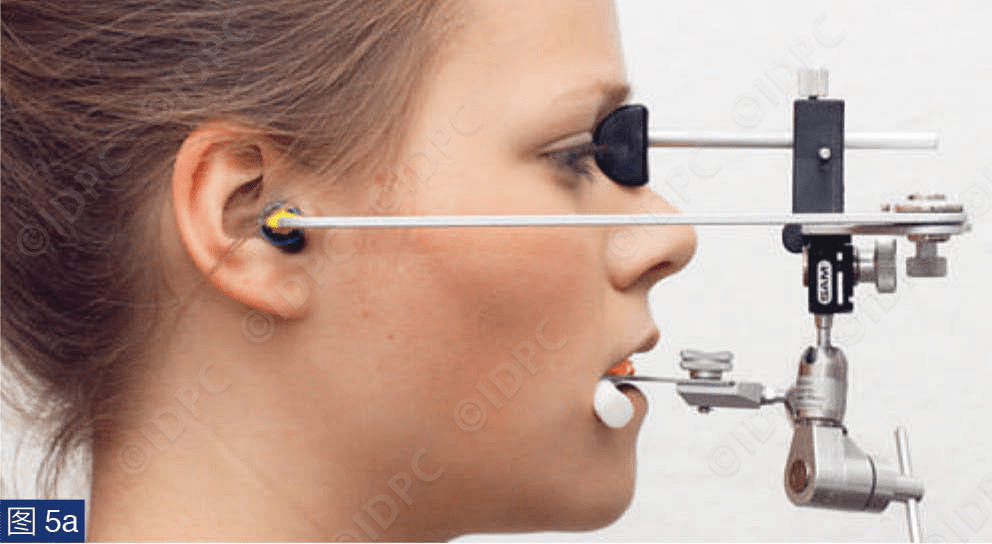 在上颌模型被安装在颌架的上颌体时,要注意观察模型的支撑(图 5b)