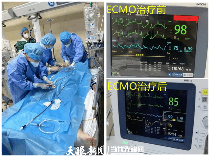 长途奔袭 生死救援 贵医附院重症医学科成功抢救两名“白肺”患者 团队