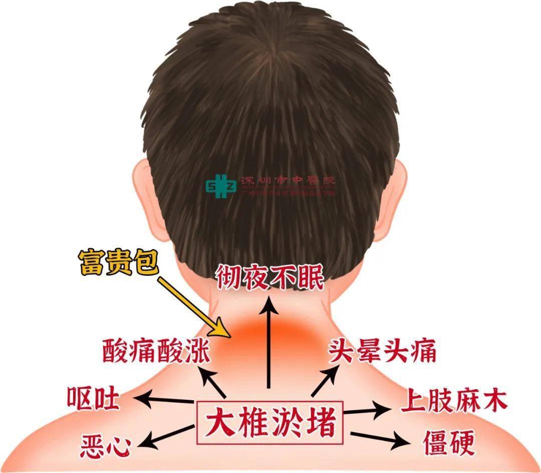 大椎不通,會堵塞七條經脈 :督脈,膀胱經,大腸經,小腸經,三焦經,膽經和