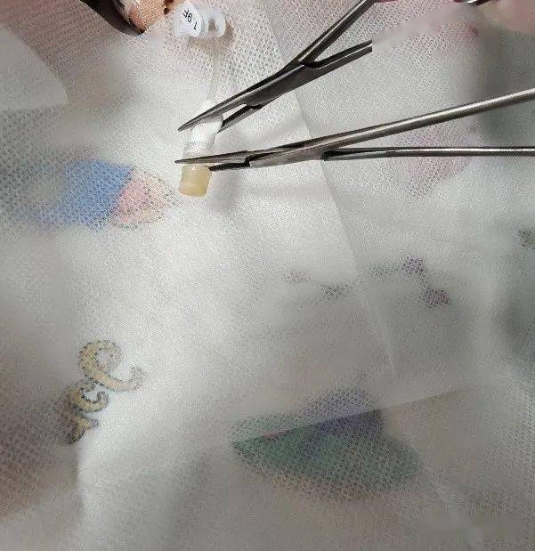 肝素帽和picc旋的过紧,拧不开怎么办?_导管_接头_护理