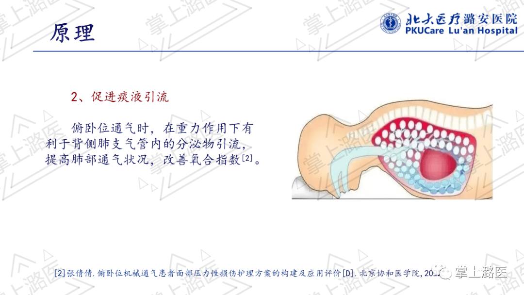 【ppt】俯卧位通气的护理