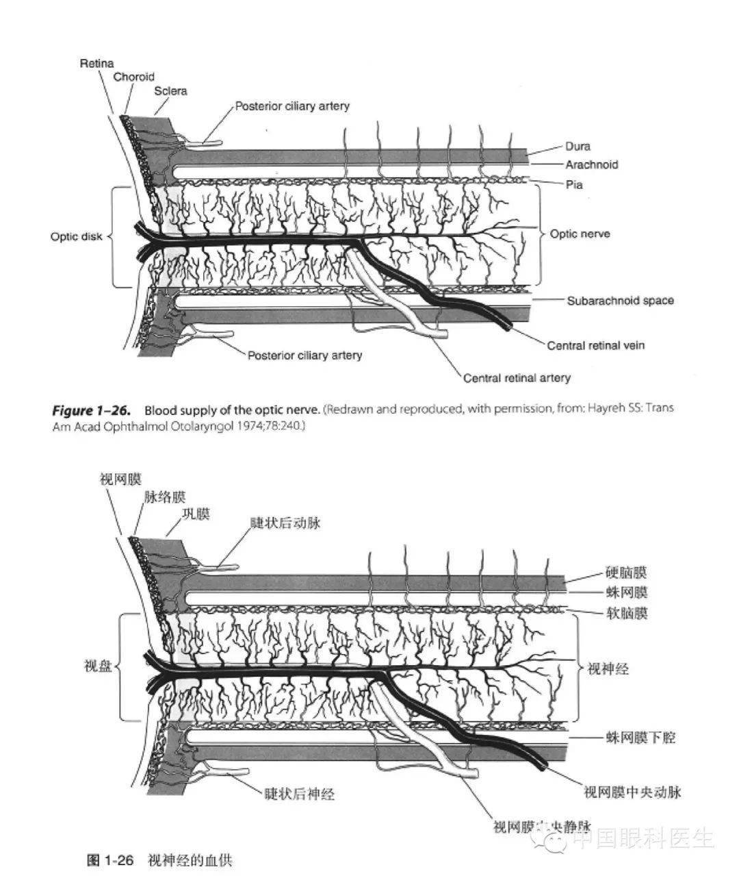 coronary artery
