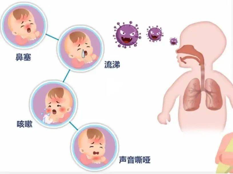 吸气性三凹征图片图片