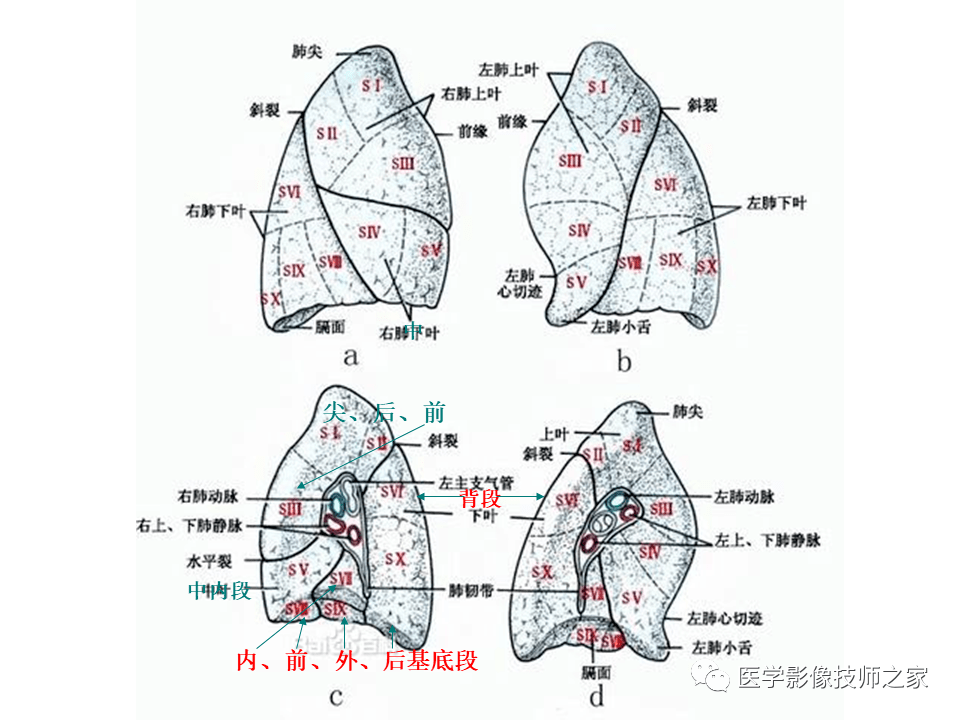 肺部ct分段解剖图图片