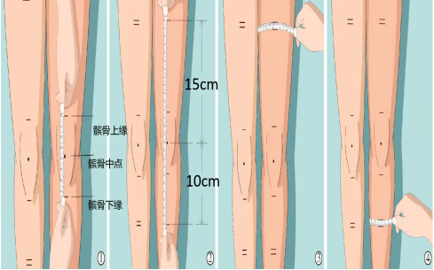 动态监测腿围患肢抬高20°~30°,膝关节屈曲,有助于静脉血液回流