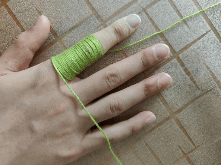 向心性缠绕压迫手指法:用直径1-2mm的线由远端向近端缠绕手指,缠 