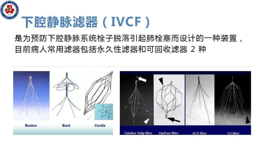 下腔静脉滤器置入术围术期护理查房