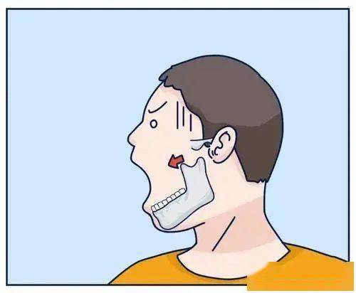 人调整方法:除咀嚼和吞咽外,适当地让牙齿保持微张状态,避免牙关紧咬