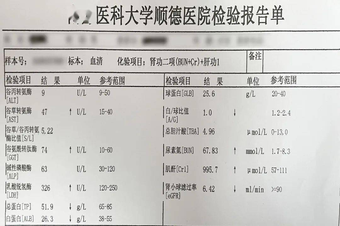 给您科普要点解读q打开化验单教你怎样正确理解肾功能,肌酐值?