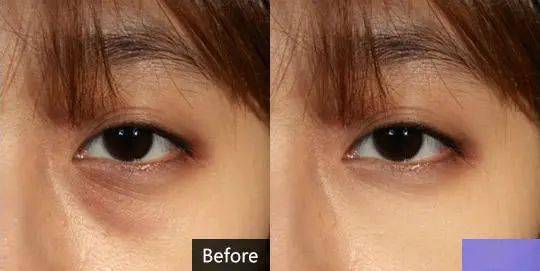 官方宣称"使用4周眼下细纹就能有效减淡近15%,8周可以淡化27%".