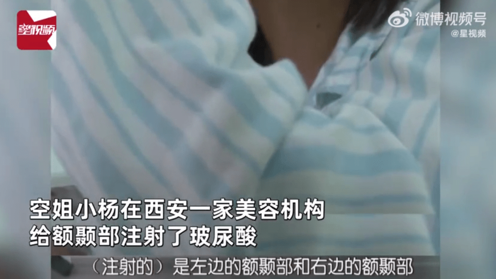 空姐注射玻尿酸打进血管差点丧命:头扎200多针被“放血”(图1)