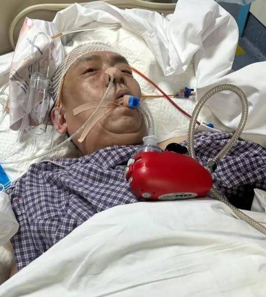 杨幂剧组司机脑溢血成植物人,剧组不管还拒付医疗费_成功_明星_北京