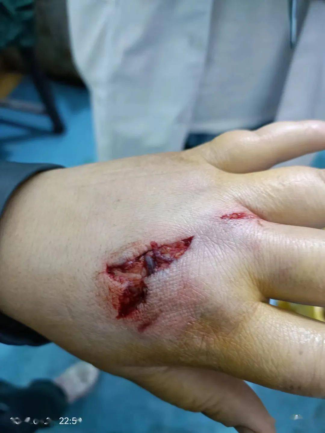 皮开肉绽,六都寨镇一恶狗连伤4人令人胆战心惊