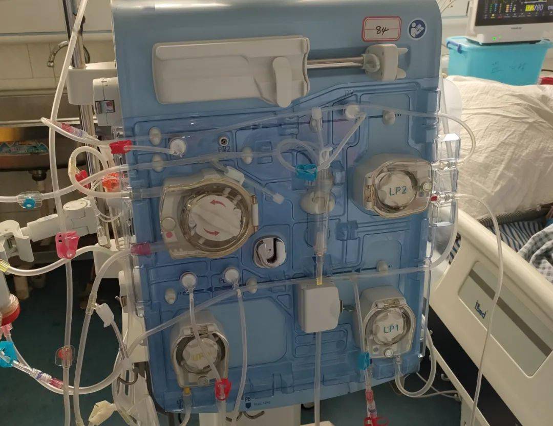 庐山市人民医院成功开展首例crrt技术,为危重患者点燃生命之光!