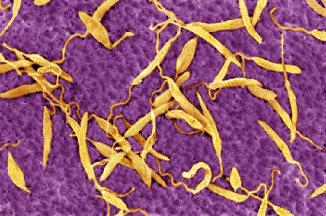 发现1例确诊病例_黑热病_白蛉_利什曼