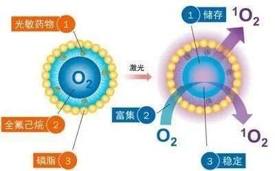 何为光动力疗法?(一)——光动力疗法的原理与作用机制_病变_组织_治疗