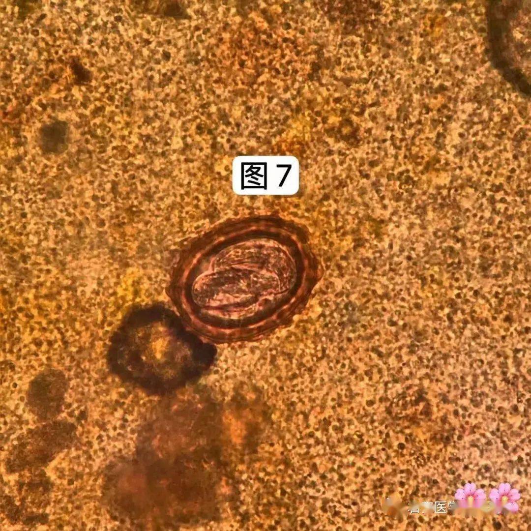 卵點擊空白處查看答案02布氏薑片吸蟲卵點擊空白處查看答案01製片方法