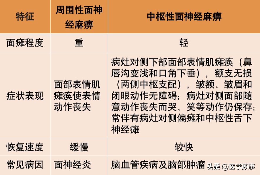 中枢性面瘫与周围性面瘫鉴别要点_面神经_纤维_病变