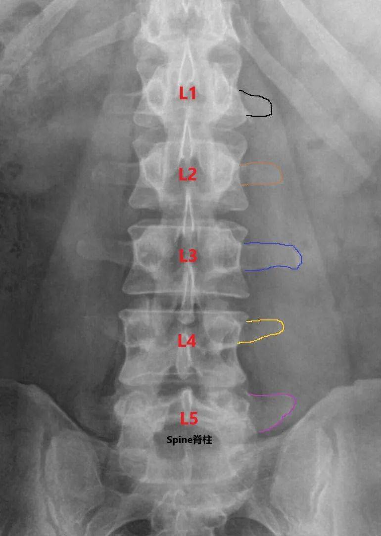 第四腰椎定位的图片图片