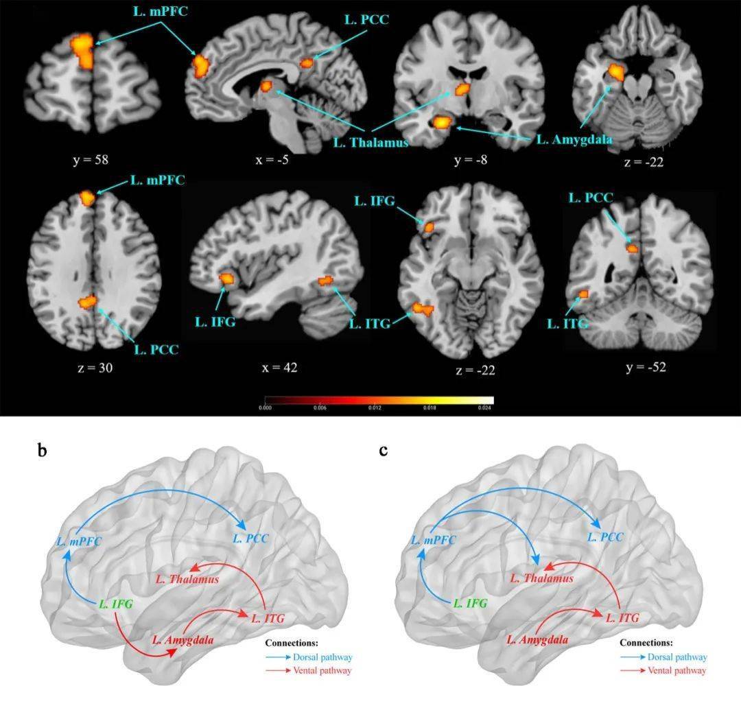 (b 母语消极词情绪加工的大脑网络连接图(c)