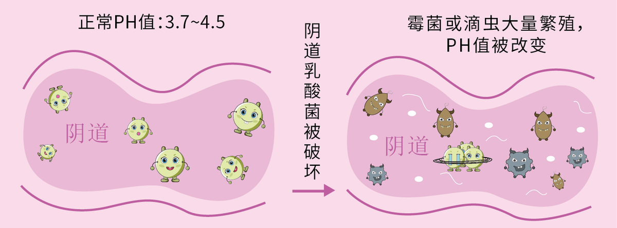 为什么会得霉菌性阴道炎