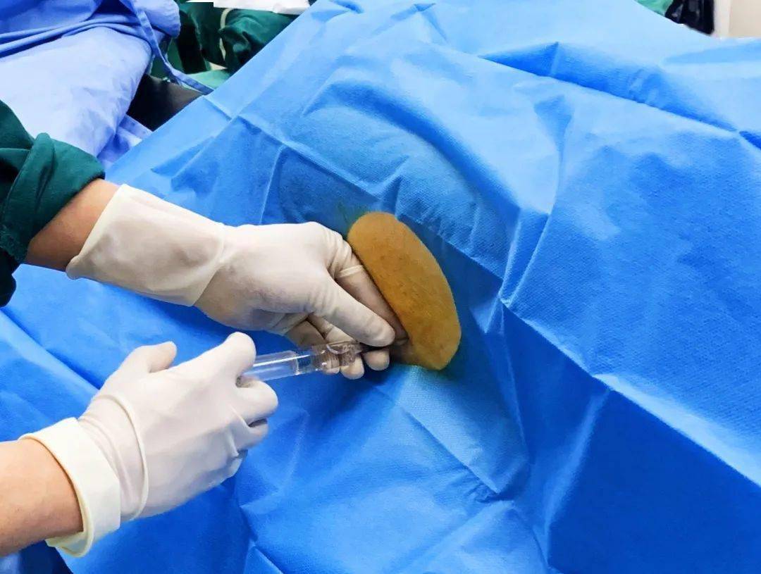 腰硬联合麻醉中,"过电感"到底是刺激了哪根神经?_感觉_脊髓_症状