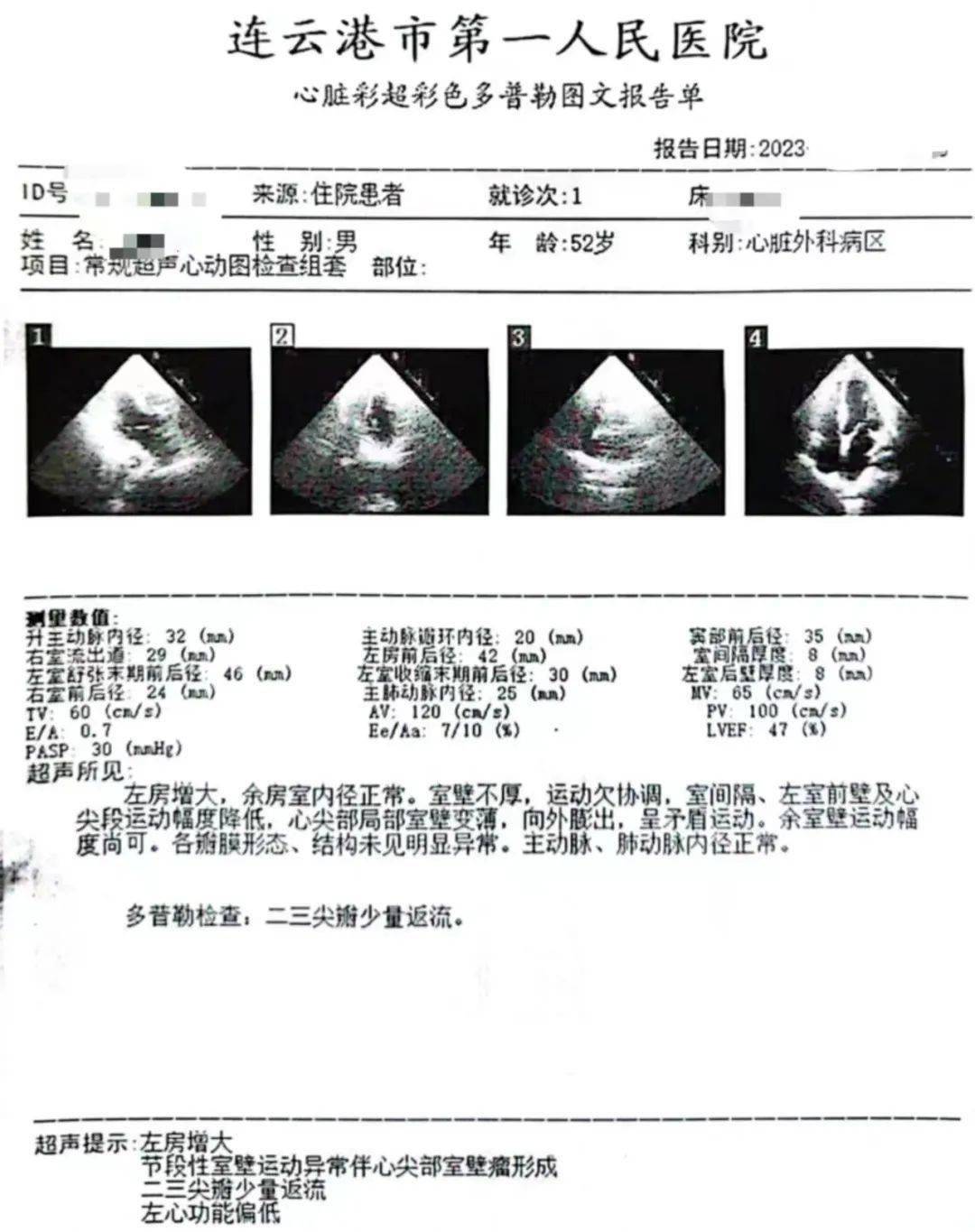 心肌梗塞的报告图片图片