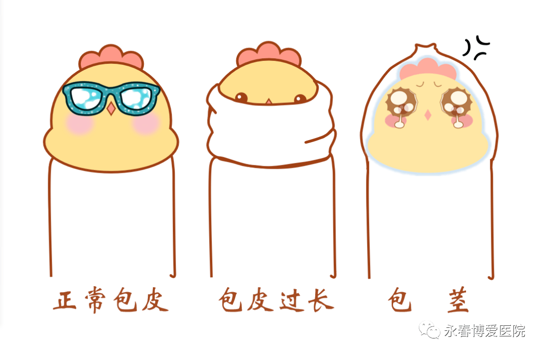 简单地说,能翻出来的,就是包皮过长;翻不出来的,就是包茎.