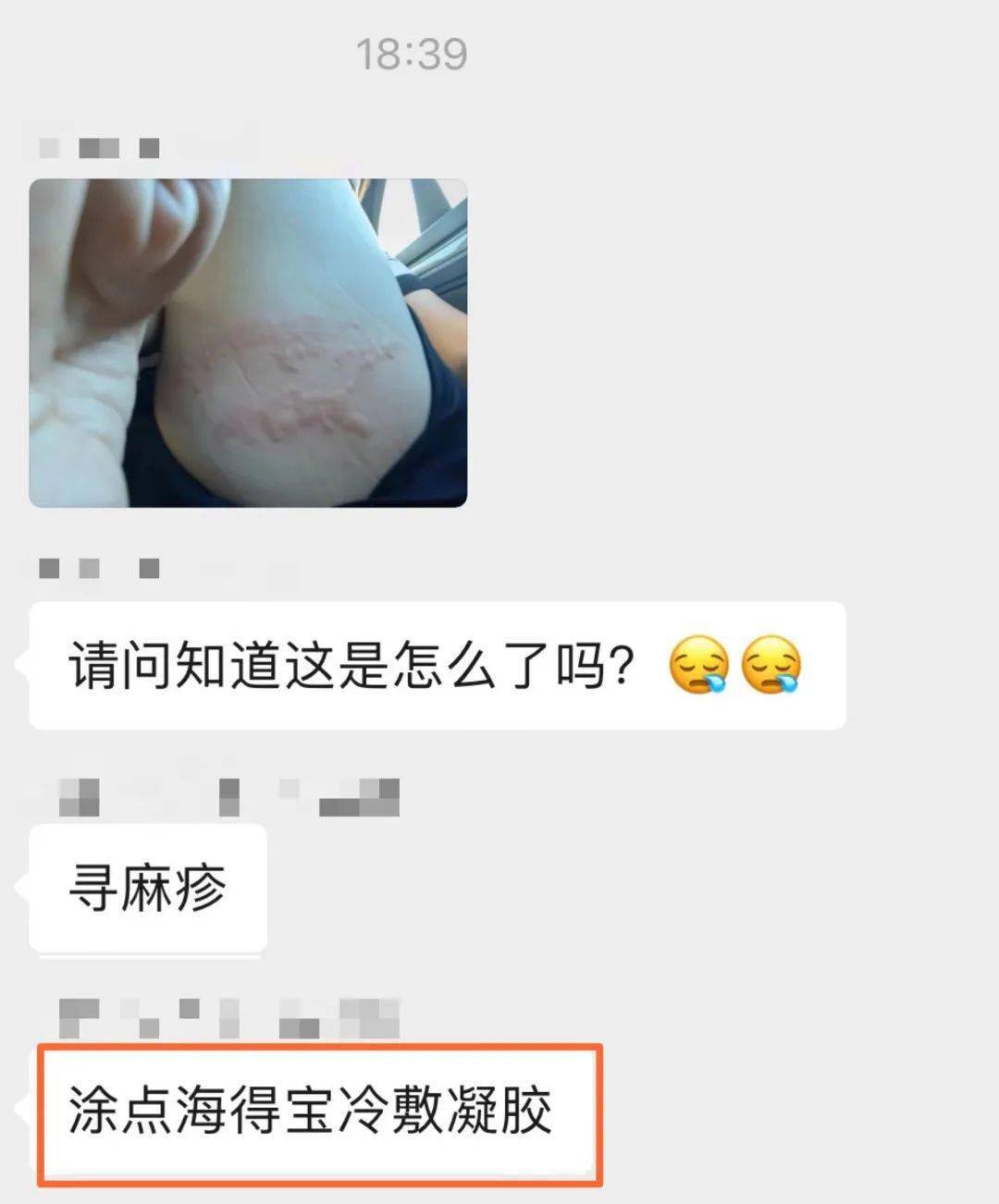 孩子皮肤随时出问题，不含激素的“止痒膏”还能抗过敏！_搜狐网
