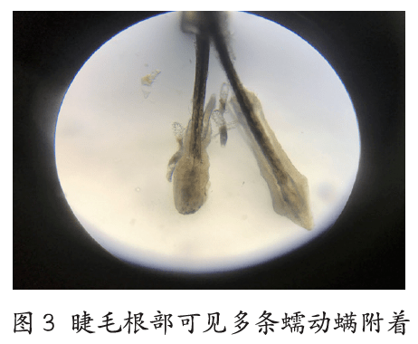 老是感觉眼睛痒,结果是长出螨虫了!_治疗_眼睫毛_症状