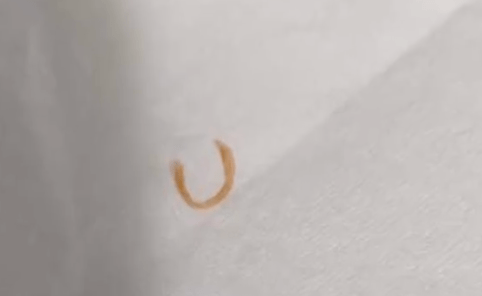 开云体育 开云官网鲍师傅糕点被曝有黑色毛发和疑似指甲异物！涉事两家门店回应