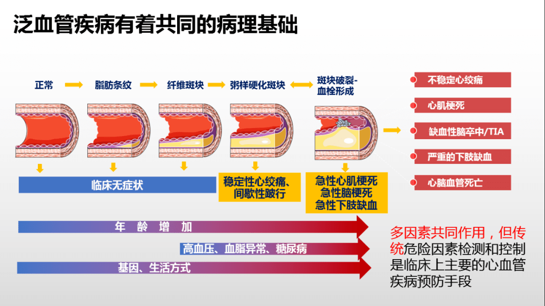 泛血管疾病大讲堂第十讲:“疏通”有道,过犹不及_烟台_公益_肿瘤
