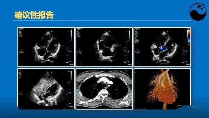 影像学诊断体格检查是临床基本功丢掉基本功谈论超声无异于丢掉很多显