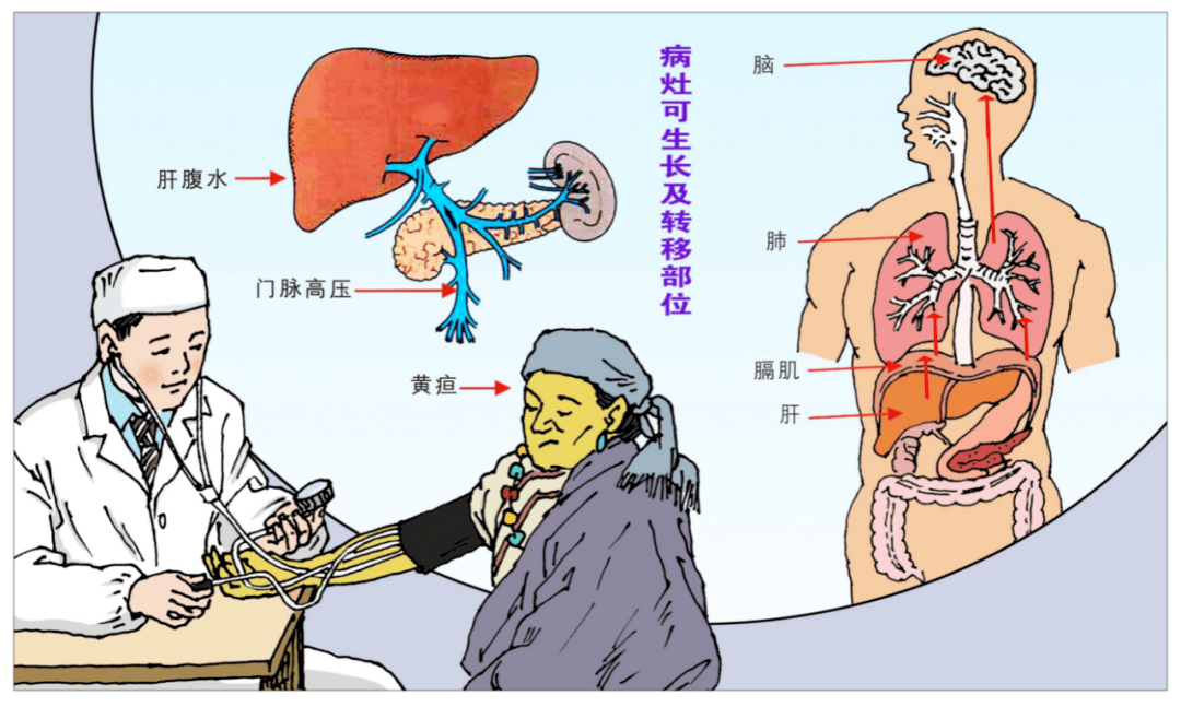 包虫病防治知识丨科普篇_虫卵_患者_动物