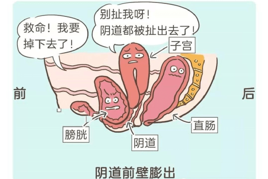 令人尴尬的秘密