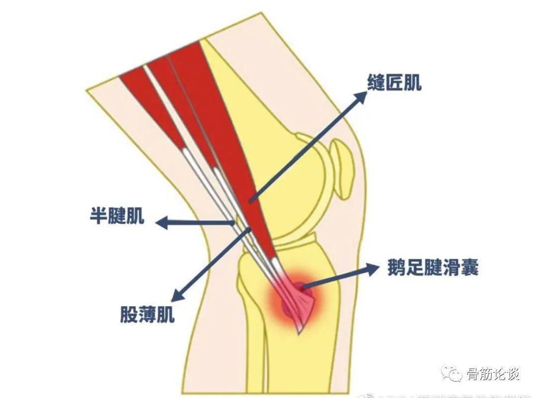 膝关节鹅掌腱位置图片图片