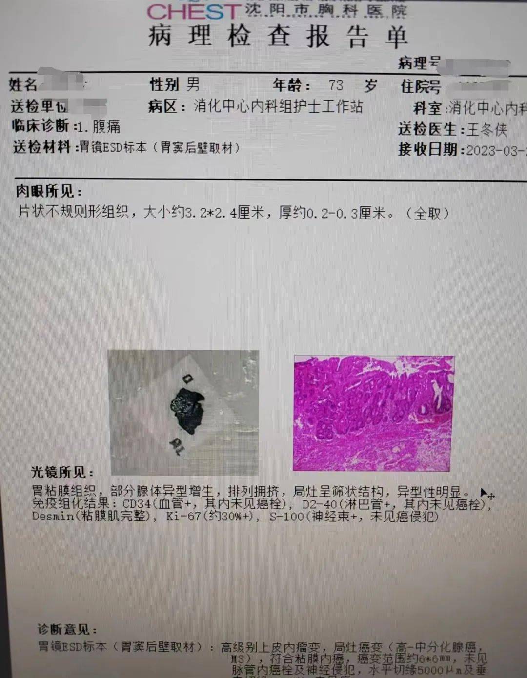消化内镜让早癌无所遁形,早诊早治让癌止步_治疗_检查_肿瘤