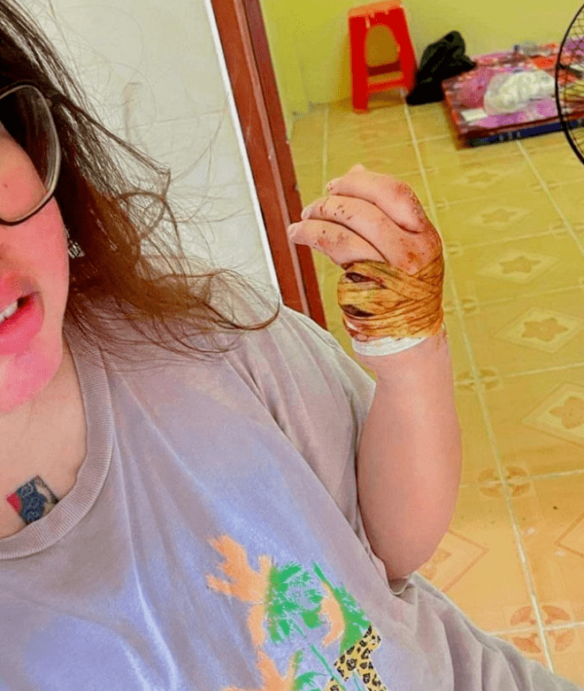 两名越南男子绑架一名妇女,剁其手指以勒索钱财_柬媒_电话_视频