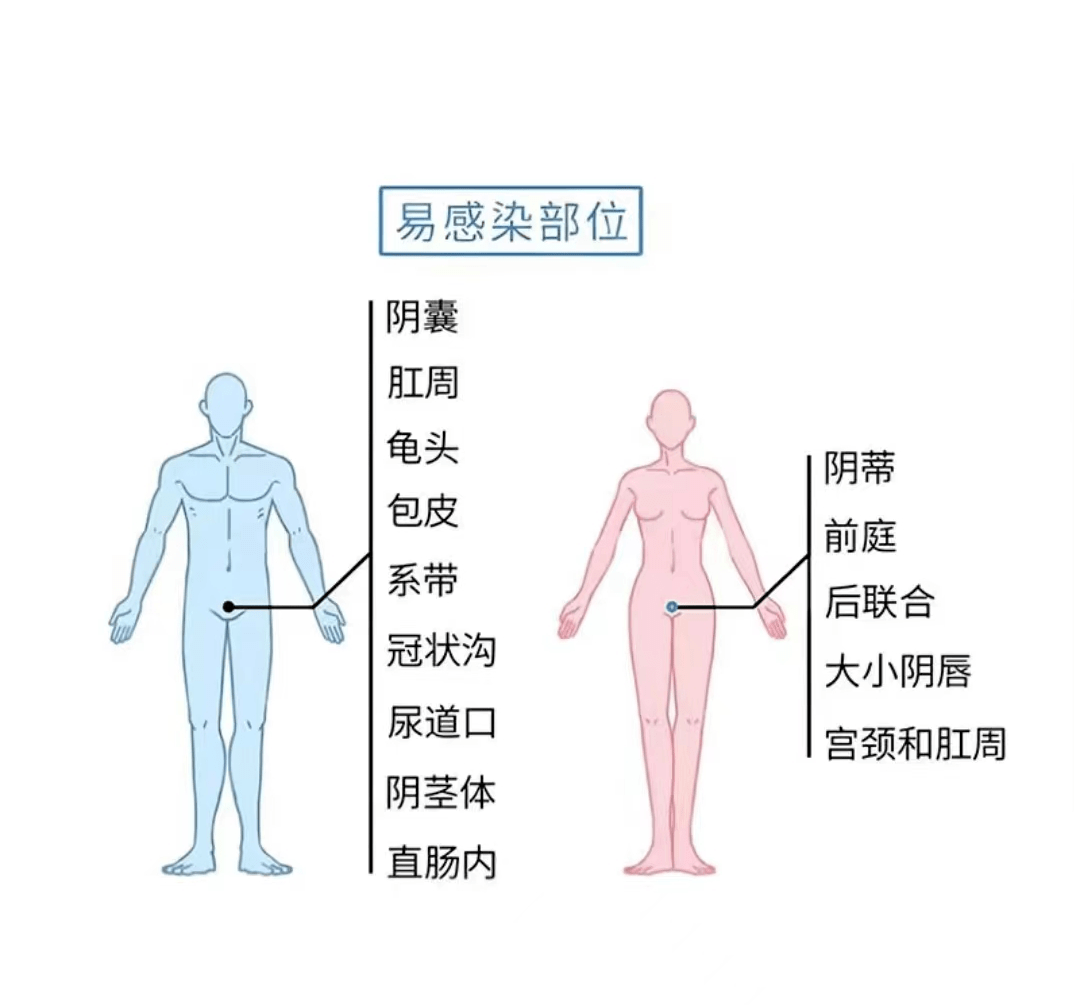 时使用安全套,但应注意感染仍可发生在未被安全套覆盖的区域如阴囊