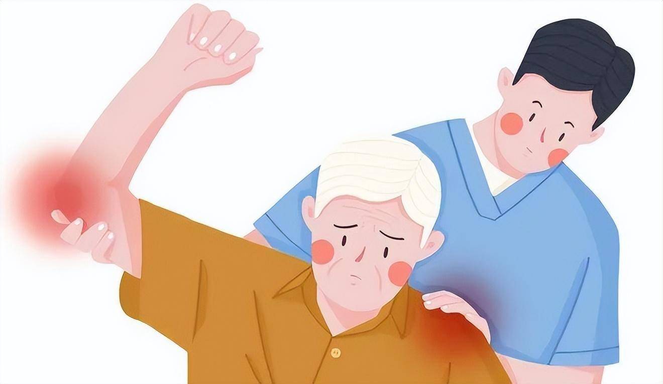 肌肉酸疼总不缓解?当心肌筋膜疼痛综合征_患者_功能_触发